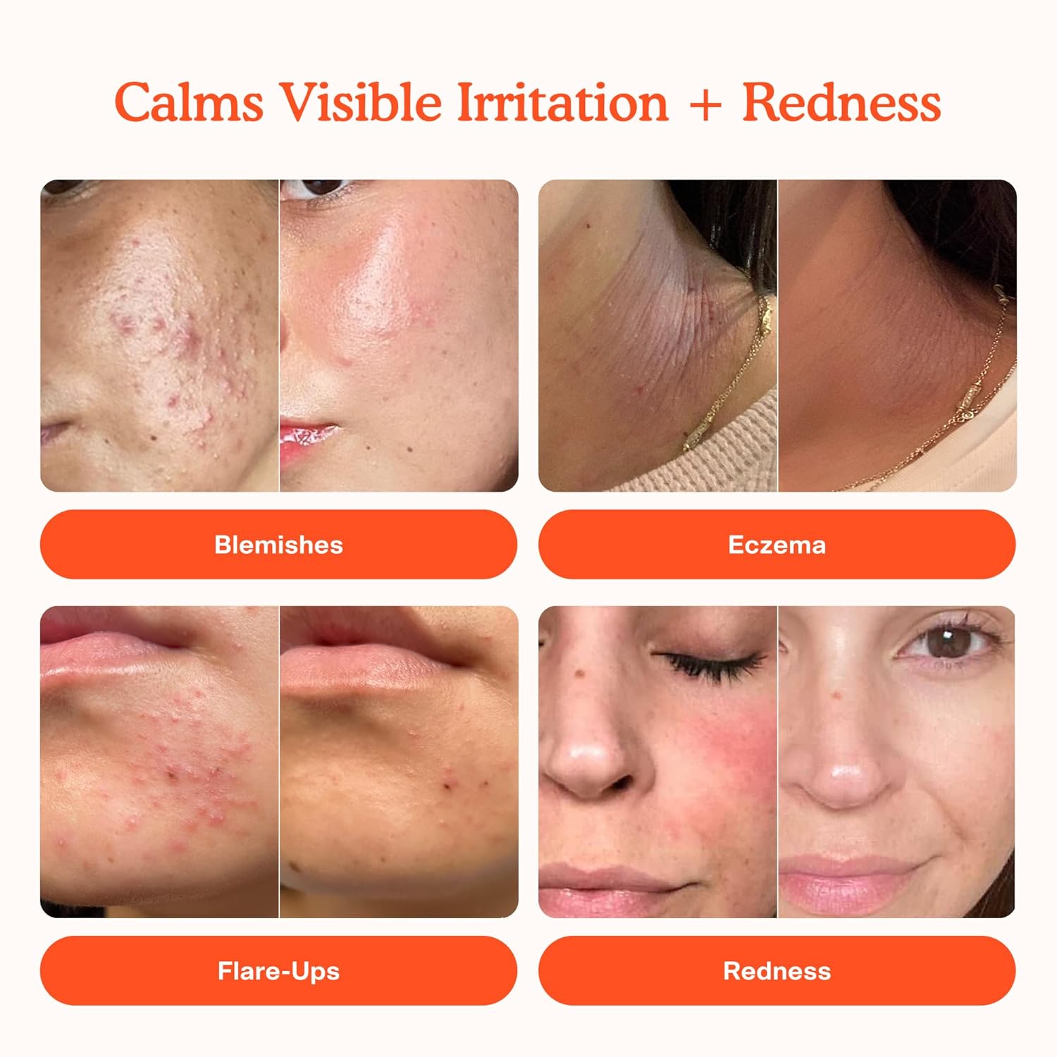 Calm Your Skin: Tower 28 SOS Daily Rescue Spray Review for Sensitive Skin