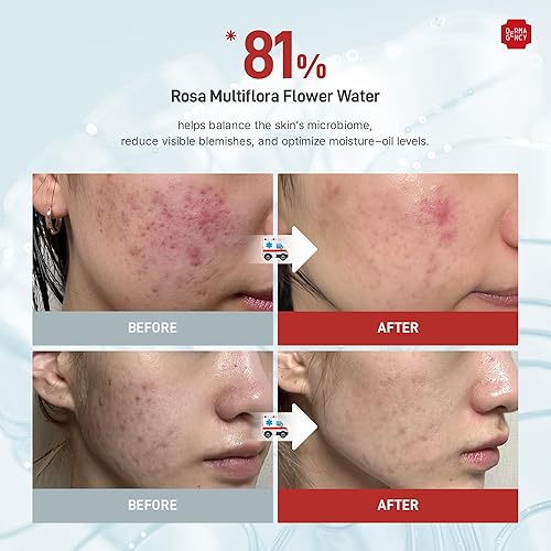 Miniatura 5 de Crema Zeroca 81 Crema hidratante coreana de rosa silvestre para piel sensible y propensa al acné, controla el sebo, hidratación ligera para una