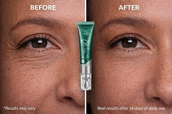 Lifting Power Eye Fluid Eyelid Lifting Treatment for Hooded Eyes & Fine Lines Multi-Peptide Eye Serum with Ceramide NG, Hyaluronic Acid & Palmitoyl Tripeptide-1 0.5 fl oz / 15 ml