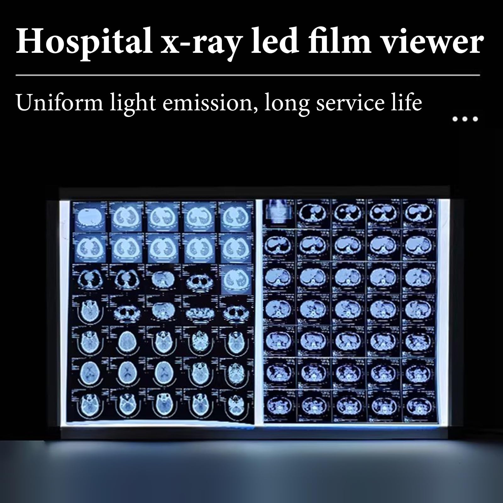 Lampada a LED per Pellicole Radiografiche Visore per Pellicole per Apparecchiature Mediche Telaio in Alluminio e Pannello in Acrilico per Cliniche e Ospedali(41x47.5x1.3cm/16.1x18.7x0.5in)