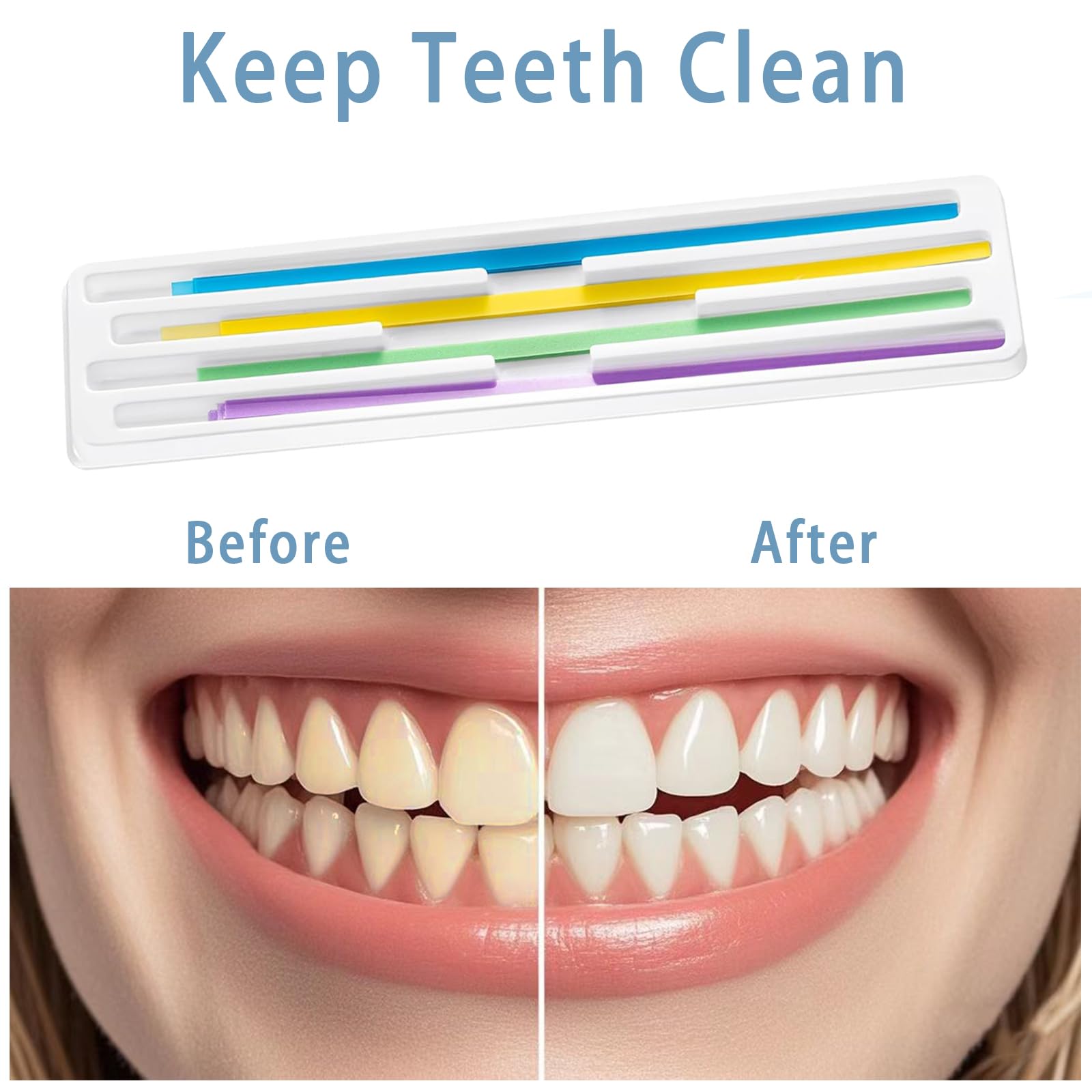 Juego de 80 tiras para pulir dientes