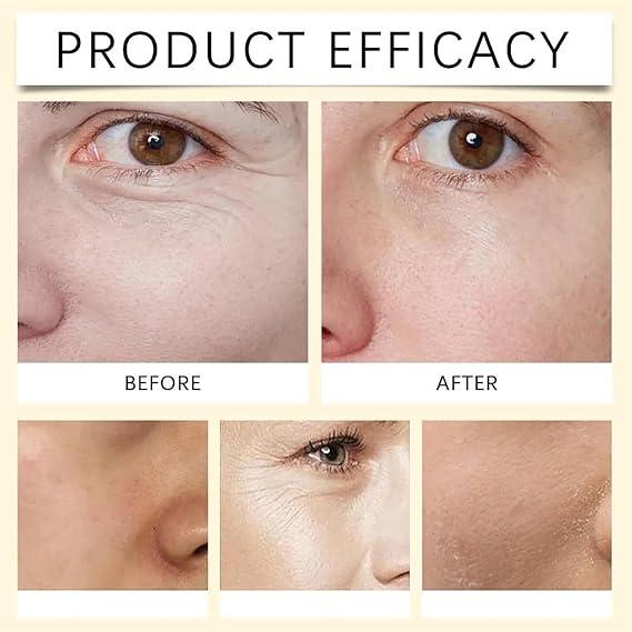 Polypeptide Collagen Elastic Essence Cream, Xianjina Peptide Collagen Elastic Firming Essence Cream, Tightening Lifting Sagging Skin (5)