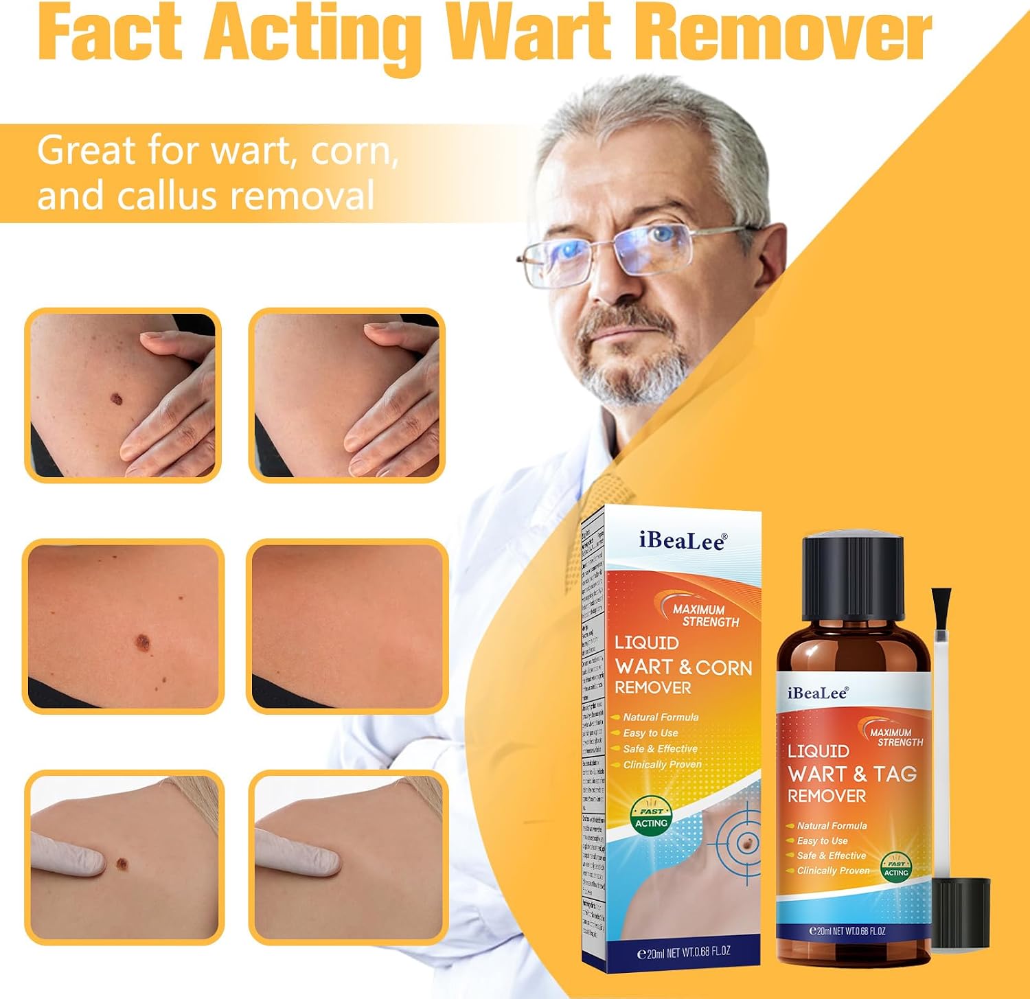 Fast-Acting Skin Tag Remover, Salicylic Acid Wart Remover for Hand Feet and Toes, Maximum Strength Liquid Skin Tag Removal for Plantar Wart, Common & Flat Wart, Callus, Corn