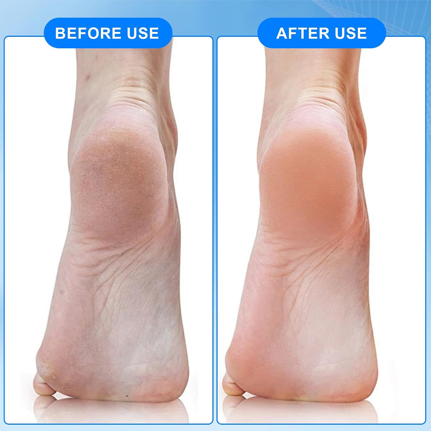 Pumice Stone Brush for Feet 2 Pack Foot Brush Foot Brush for Shower Foot File Callus Remover 4-in-1 with Foot Scrubber, Pumice Stone, Foot Rasp and Sand Paper for Home Foot Care