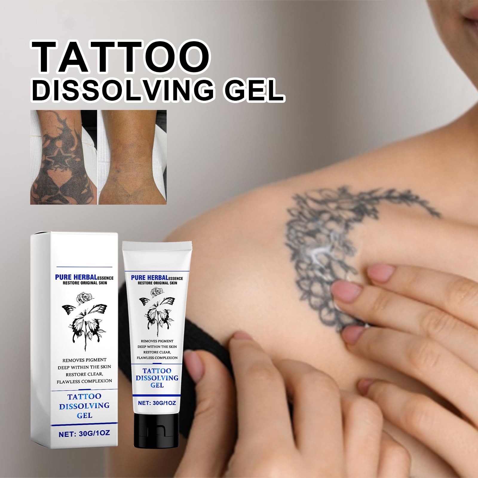Rimozione tatuaggi Prima e dopo Rimozione tatuaggi Prima e dopo