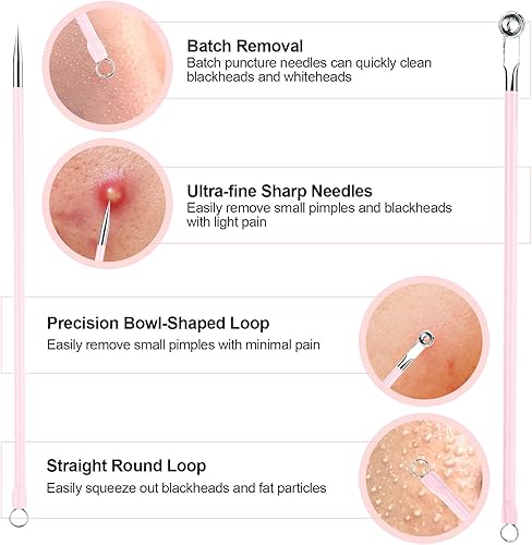 Miniatura 3 de 8 herramientas para eliminar puntos negros, aguja de espinillas, acero inoxidable, kit de herramientas rosa con estuche de almacenamiento, extractor