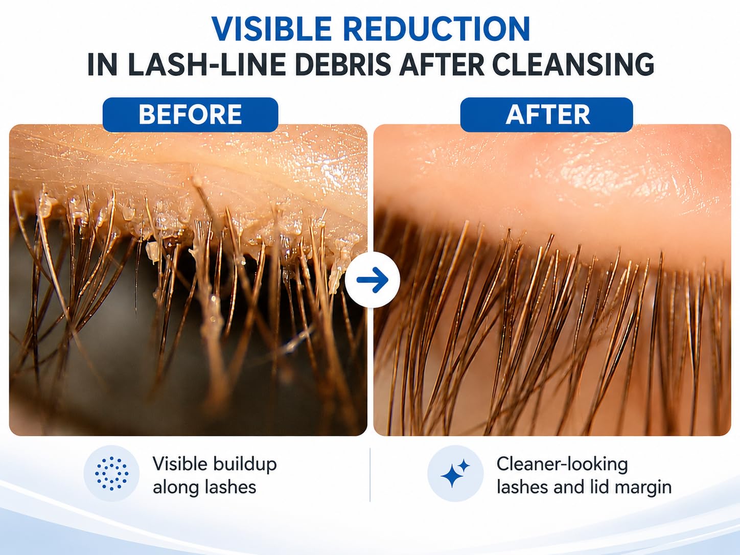 Mybo Clean Eyelid Cleansing Brush for Sensitive Skin (1 Pc) + Hydrating Lids and Lash Cleansing Gel (1Pc) + Travel Bag Ideal for Gentle Cleansing of the Eyelids On the Go