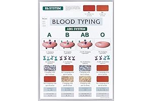 Blood Typing Chart, Visual Display Of The Abo System And Rh System,...