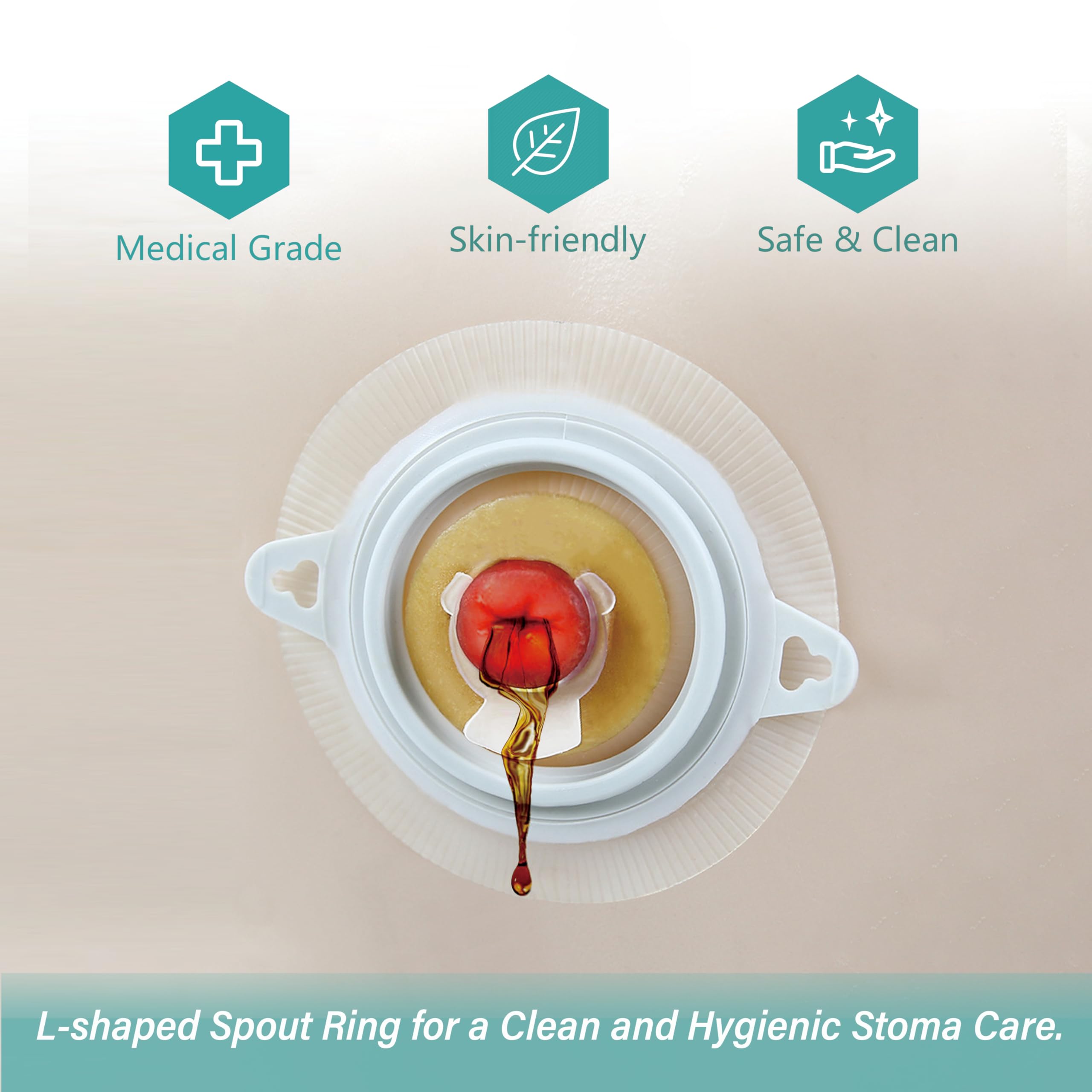 Ostomy Barrier Rings with L-shapped Output Direction Spout, Ostomy Stoma Rings with L-shapped Groove, Ostomy Supplies,Colostomy Supplies,4 Pcs/Pack (2mm Thickness, Diameter : 1.9 Inches)