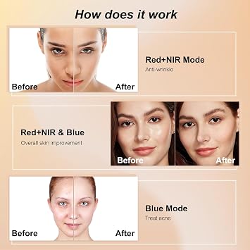 Avorla LED Light Therapy Mask, LED light therapy for face to reduce wrinkle and acne, Red, Blue & Near Infrared Facial Skincare Device