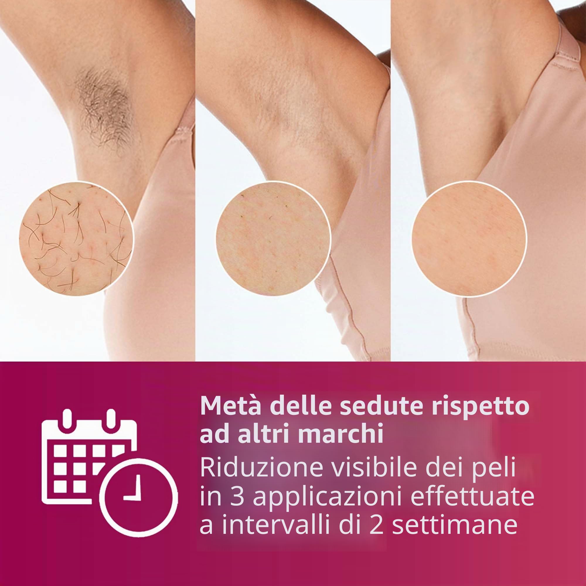 Philips Lumea Advanced Dispositivo di epilazione IPL SC1997/00