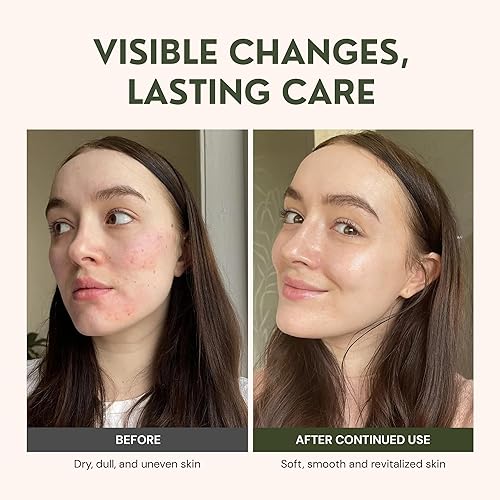 Miniatura 7 de Sarga de carne para el cuidado de la piel  100% pasto alimentado con pasto acabado con jojoba orgánica, tuna espinosa, rosa mosqueta, aceites de