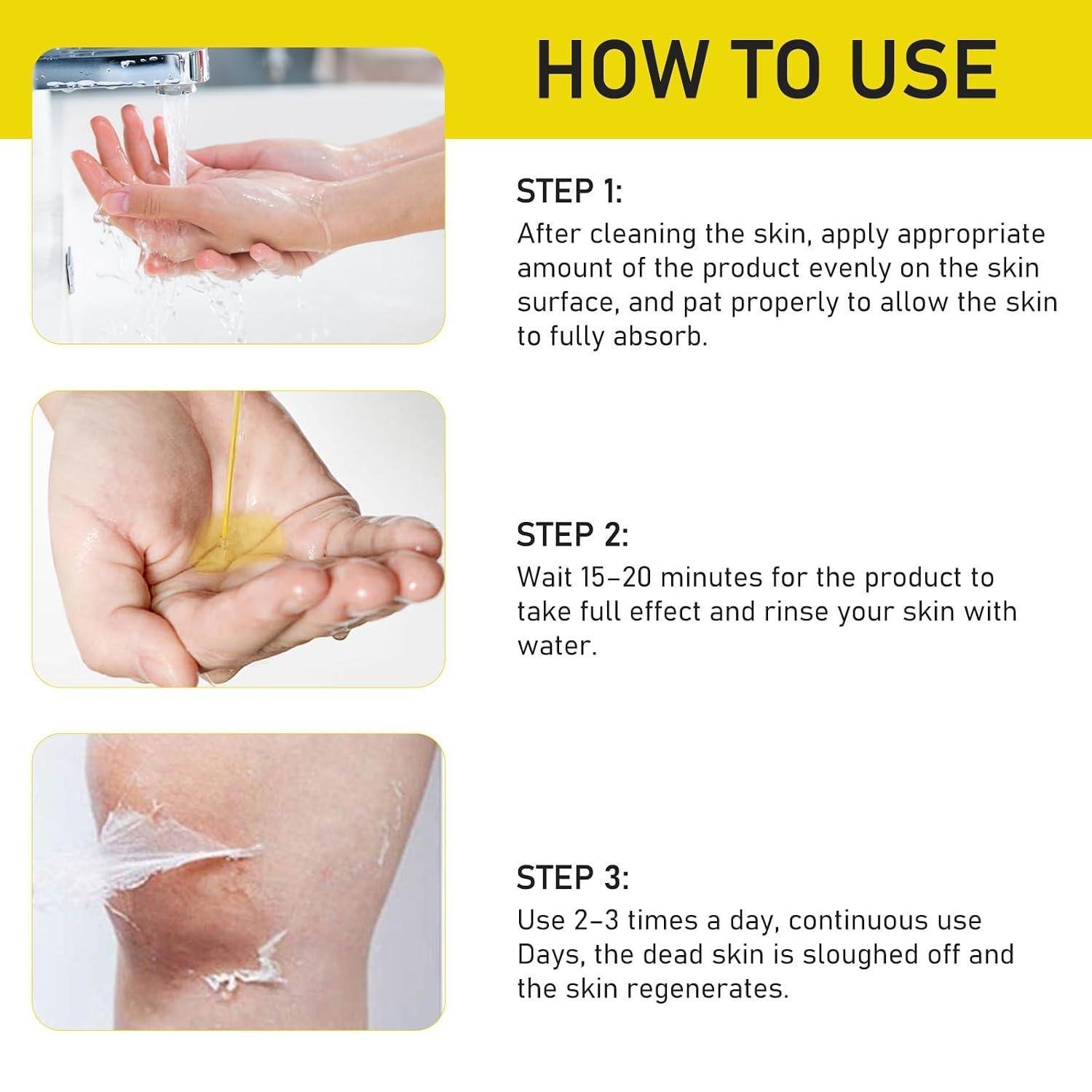 Yellow Peeling Oil for Dark Skin, Extra Strong Peel Oil for Body Hands Arms Feet Legs Dark Knuckle Dead Skin Exfoliating, 3.38 fl.oz/100 ml