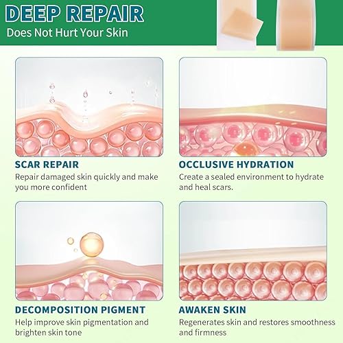 Miniatura 4 de Cinta de silicona para cicatrices actualizadas, hojas de cicatrices de silicona para cicatrices quirúrgicas, tira de cicatriz de silicona