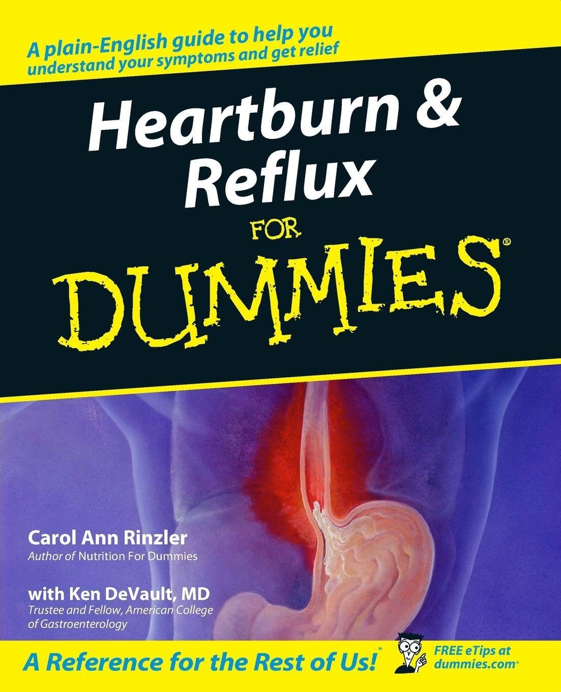 Heartburn and Reflux for Dummies by CA Rinzler PAPERBACK 9780764556883