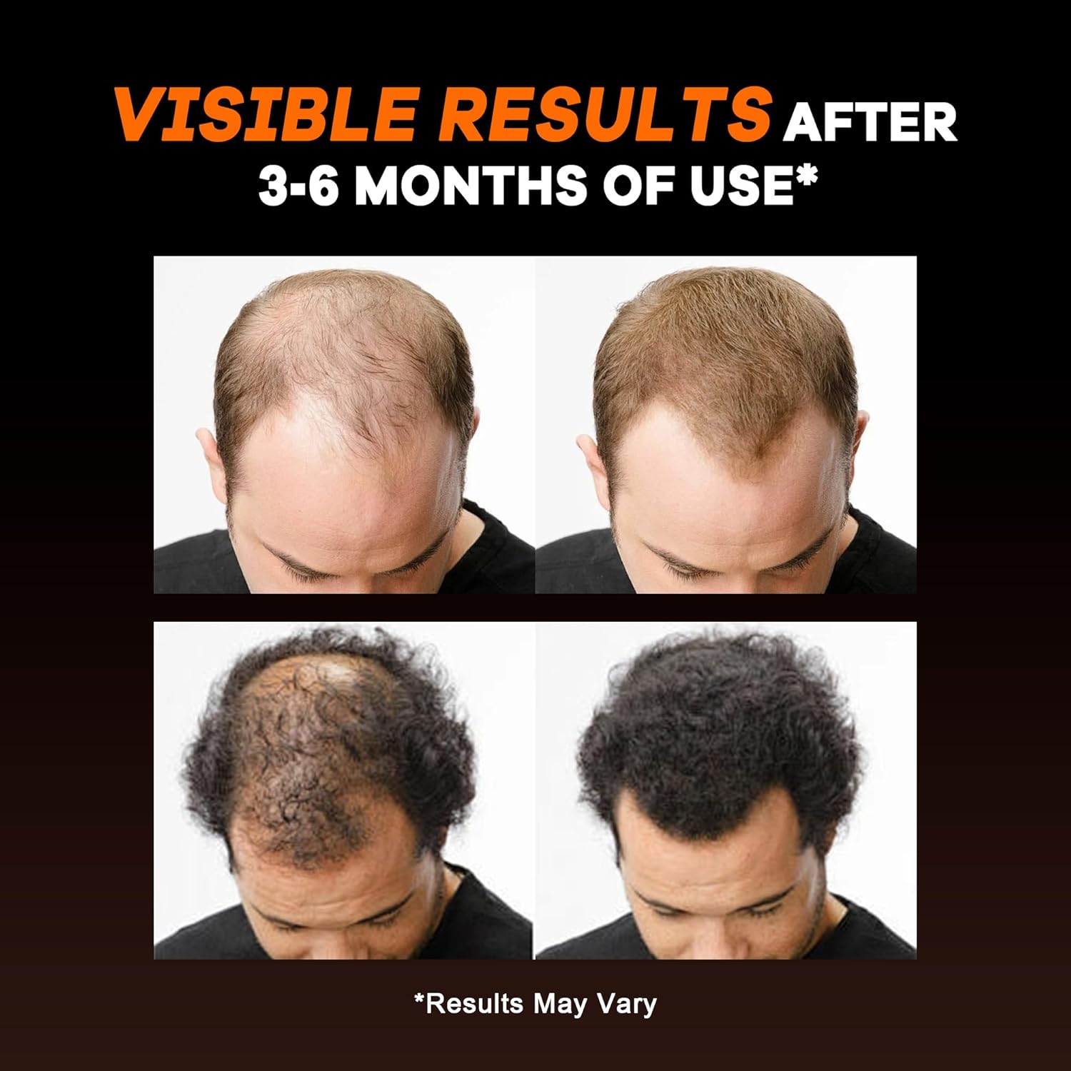 DHT Blocker for Men Hair Growth: Natural Hair Loss Supplement - Formula with 10000mcg Biotin & Saw Palmetto for Mens thinning Support - 1 Monthly Supply - Image 3