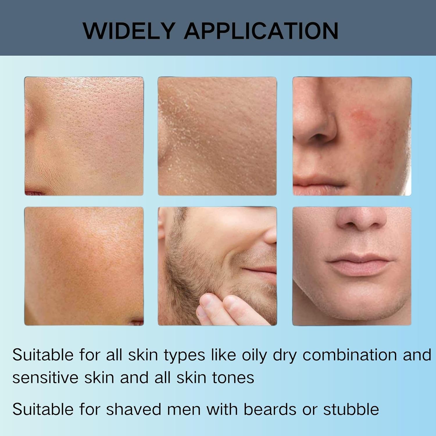 3 Pcs Organics Acne & Redness Killer,Acnes and Redness Relief Balm,Remove Skin Care Set,Ultra-Performance Skincare for Men and Women - Image 6