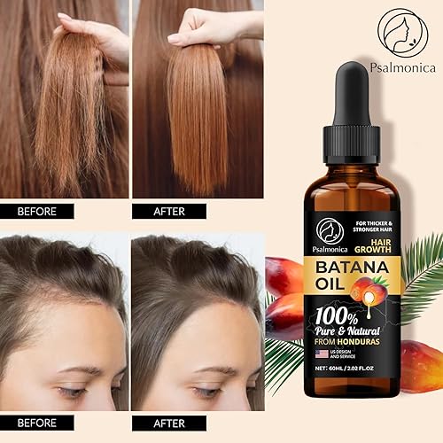 Miniatura 2 de Suero de crecimiento del cabello con aceite de batana 100% puro suero natural para cabello más grueso y fuerte, aceite eficaz para el crecimiento