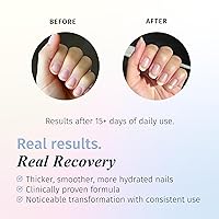 Vista 2 de Sistema de crecimiento de uñas dURI Rejuvacote, de 61 onzas