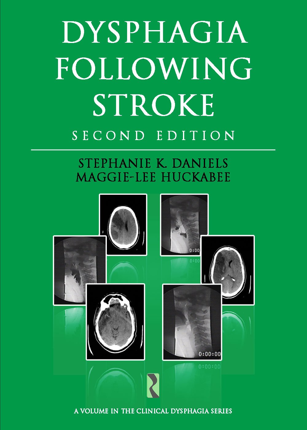 Dysphagia Following Stroke 2nd Edition