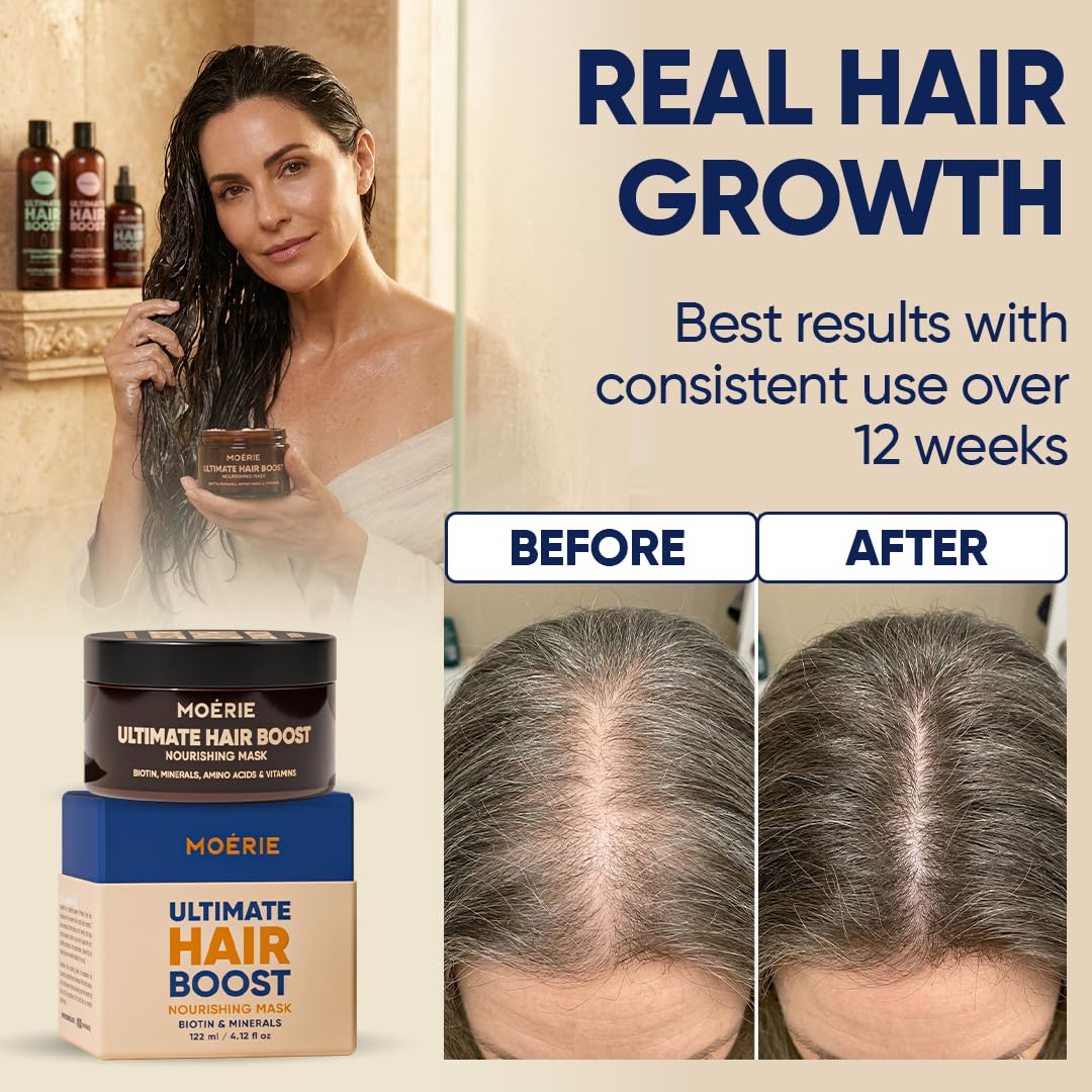 Moerie Mascarilla Hidratante Cabello Mineral Para Crecimiento Y Reparación Capilar – Tratamiento Hidratante Para Cabello Más Largo Y Grueso – Producto Vegano Sin Parabenos Ni Silicona – 100 ml X3