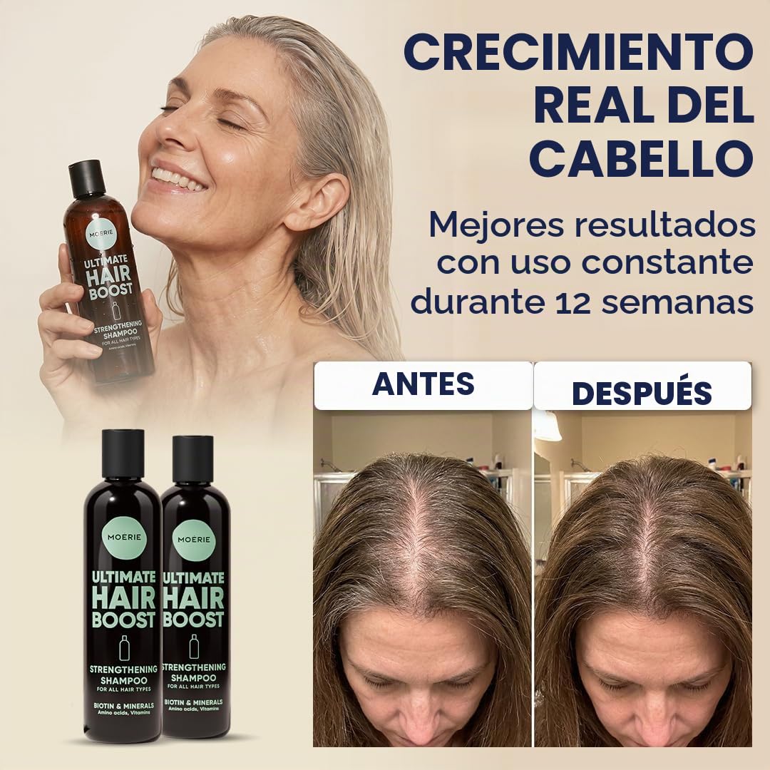 Moerie Ultimate champu de cabello crecimiento – pelo Grueso y Abundante - Shampoo Anticaída Mujer – Producto voluminizante - vegano - sin parabenos ni silicona - todo tipo de cabello – 250 ml X2