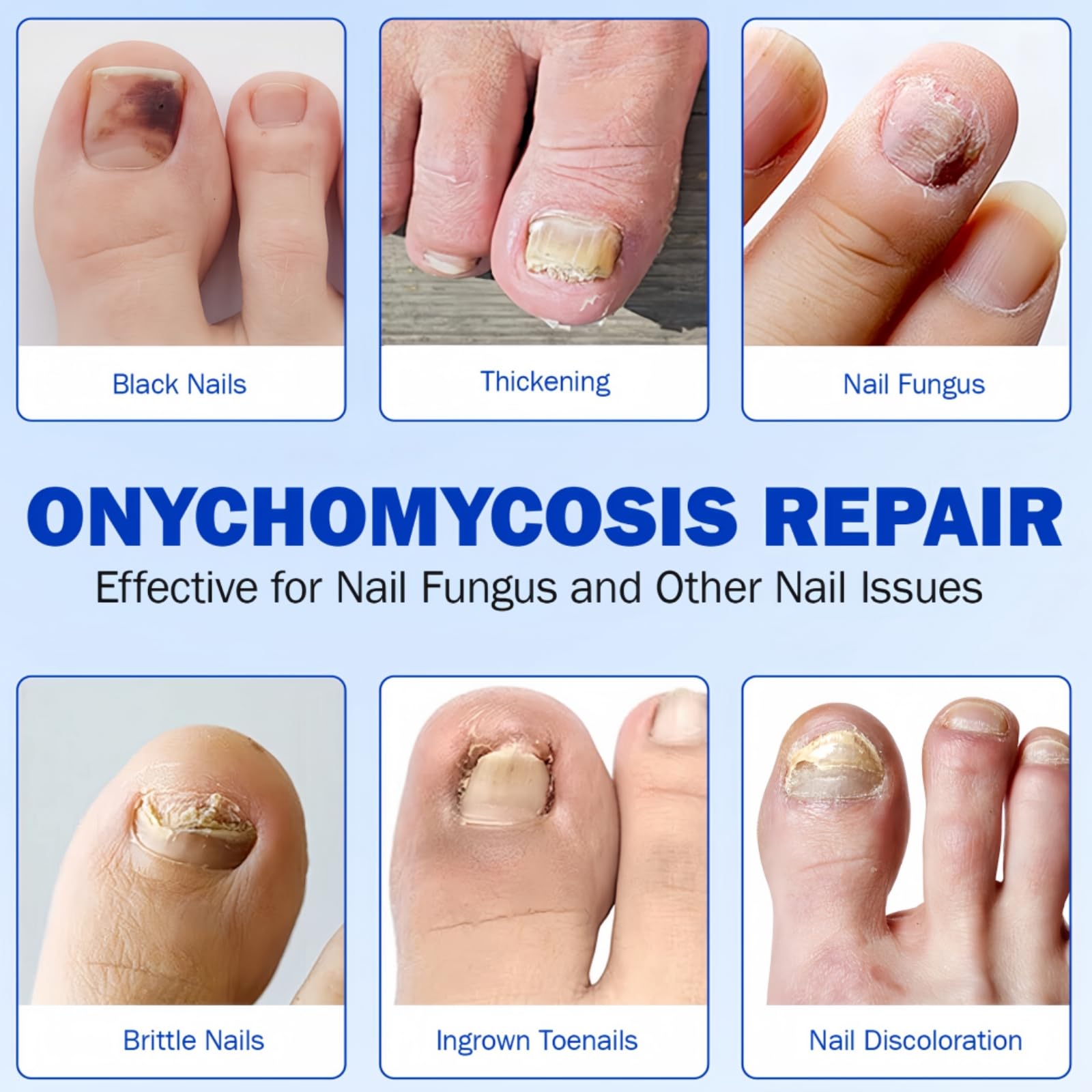 21 Pcs Fungal Nail Treatment Patches, Toenail Repair Pads for Targeted Relief, Antifungal Nail Treatment for Toenails - Image 4