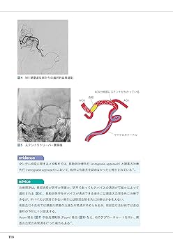 脳神経外科  脳血管障害の急性期マネジメント1 脳血管障害の急性期マネジメント 81ZfSQdRO7L._AC_UL210_SR210,