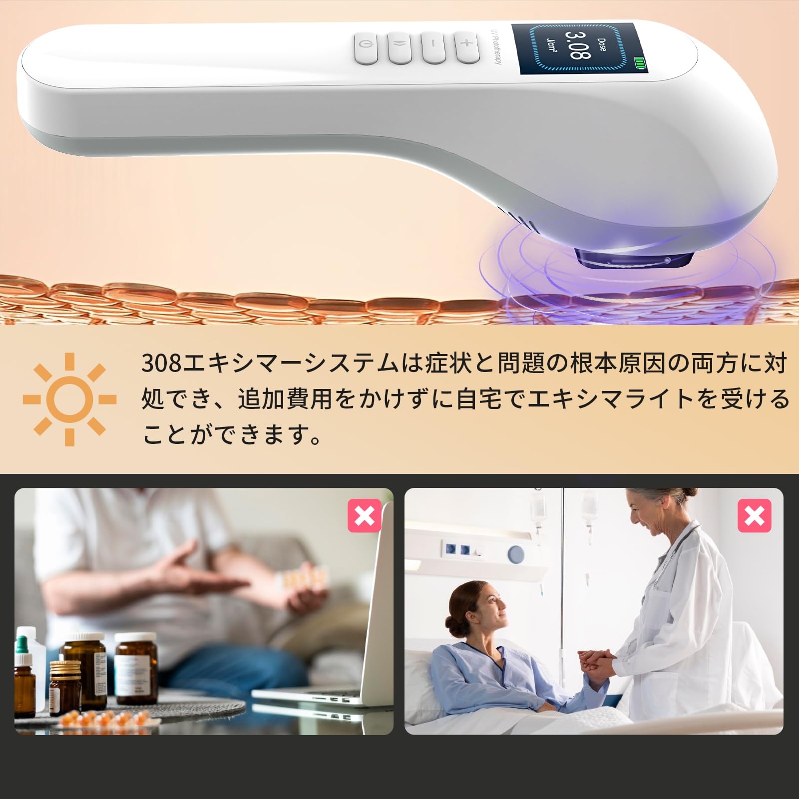 Amazon | エキシマライト光線 308エキシマーシステム 家庭用エキシマー 