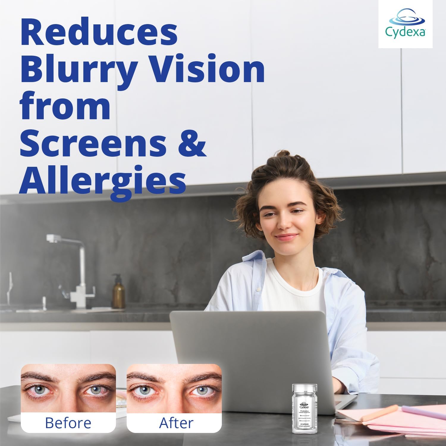 Only Probiotic Supplements for Dry Eye with Entrocoat & Vitamin D₃ – Scientifically Developed Eye Vitamins for Eye Gut–Eye Axis Support – Ophthalmologist-Formulated for Dryness & Redness (Pack-of-01)