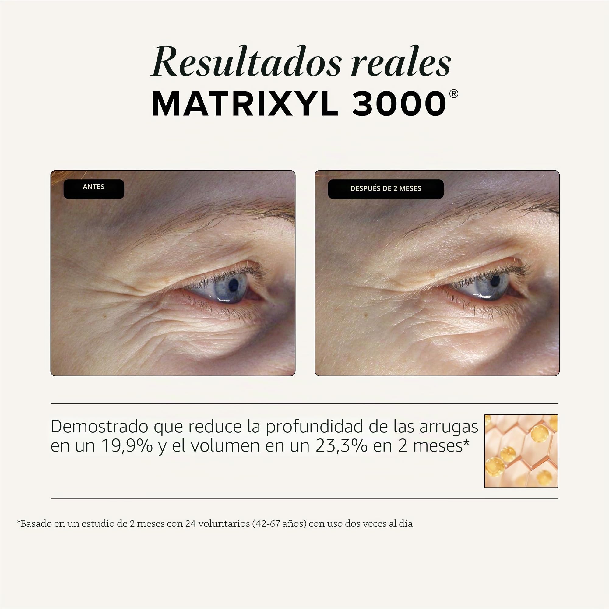 ASTERWOOD - MATRIXYL 3000 + ARGIRELINE + Vitamina C - Sérum con ácido hialurónico orgánico - 3000 ml - Reducción de manchas solares y arrugas