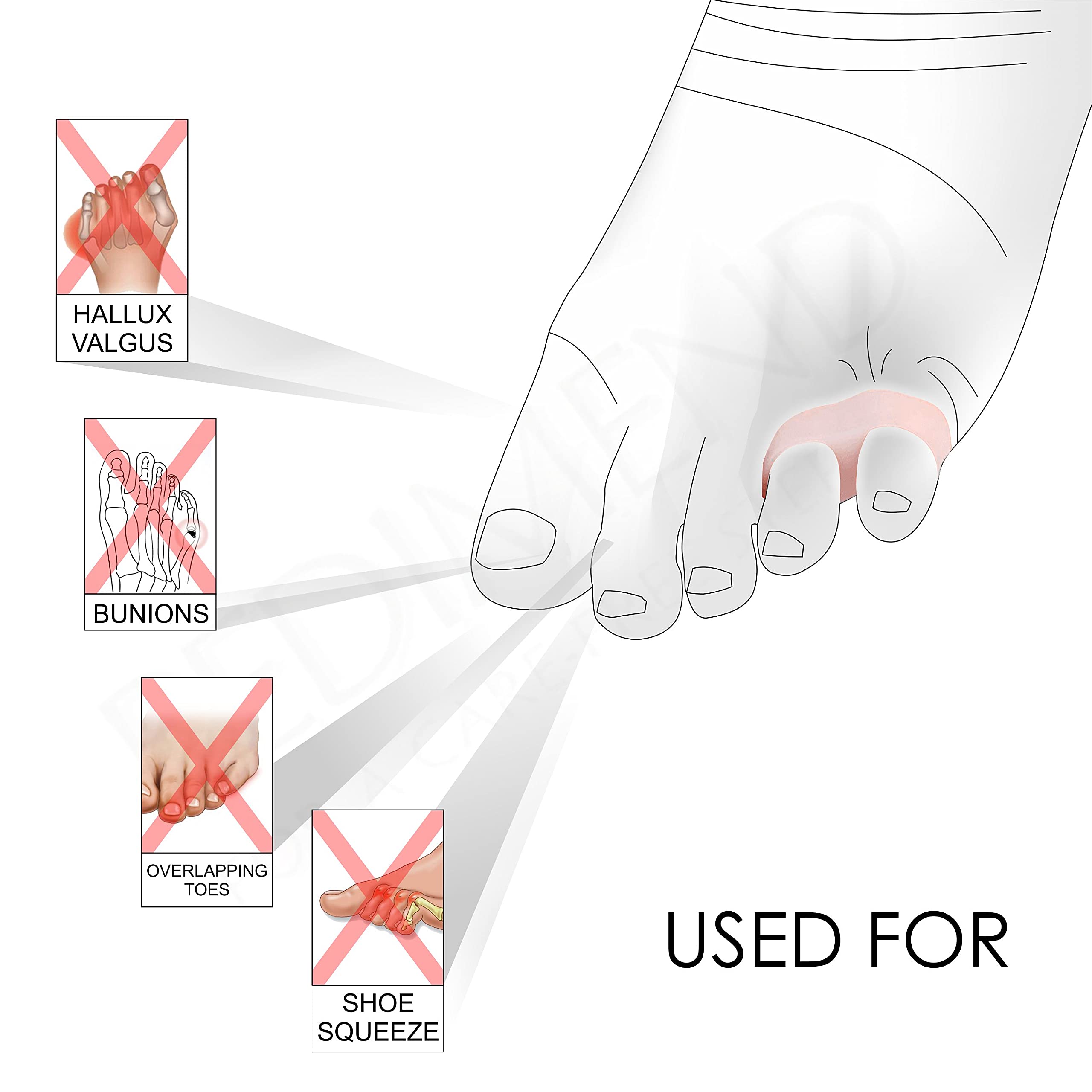 Pedimendtm Little Pinky toe silicone gel separatore schermo – 6 pezzi | da sarto alluce valgo separatori | Bunionette sollievo dal dolore