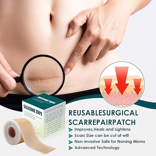 Miniatura 7 de Cinta de silicona para cicatrices, láminas de gel de silicona premium (rollo de 1.6 x 60 pulgadas - 4.9 ft), parches de silicona reutilizables,