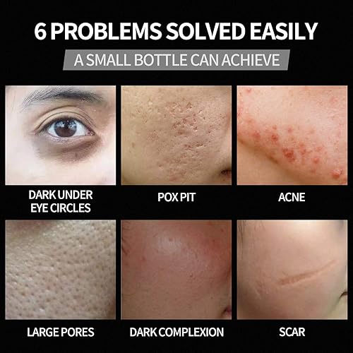 Miniatura 3 de immetee BB Cream para hombres, hidratante tintada para la cara, corrector para ojeras y manchas, cuidado de la piel para hombres y uniforme tono de