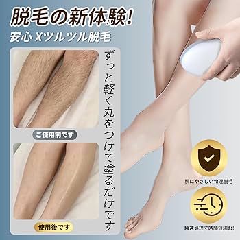 CNVレーザー脱毛 Amazon | YUNDOO 脱毛器 VIO対応【2025年新モデル・1台3役（HR