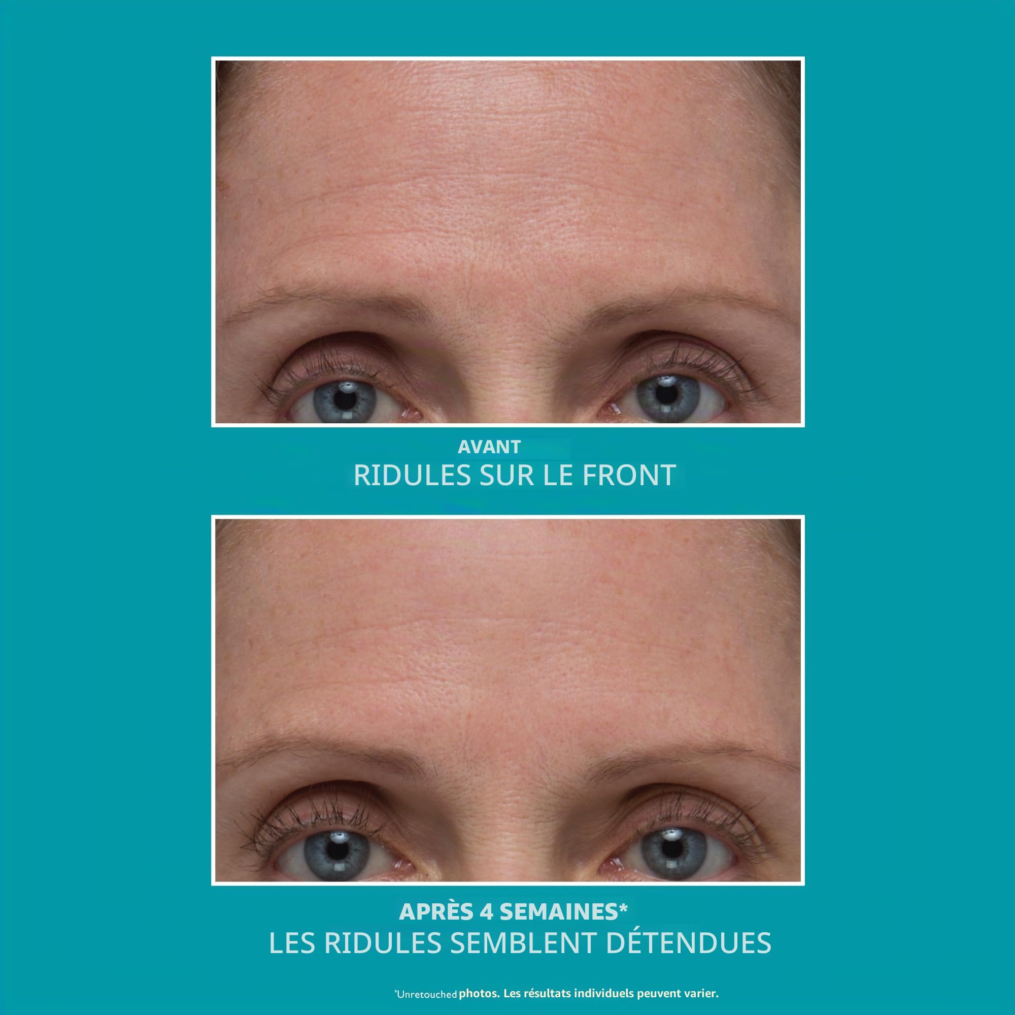 Peter Thomas Roth - Peptide Skinjection™ Sérum Réduction des Rides Rechargeable - Sérum Anti-Âge avec Peptides, Soin Lissant & Hydratation Intense