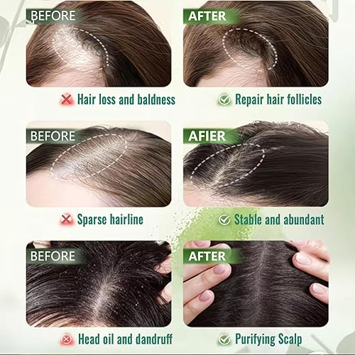 Miniatura 3 de Nature Triangle Barra de champú, champú de jabón verde Nature Siete, calmante y fortalece el cabello para mujeres y hombres con una red de espuma (2