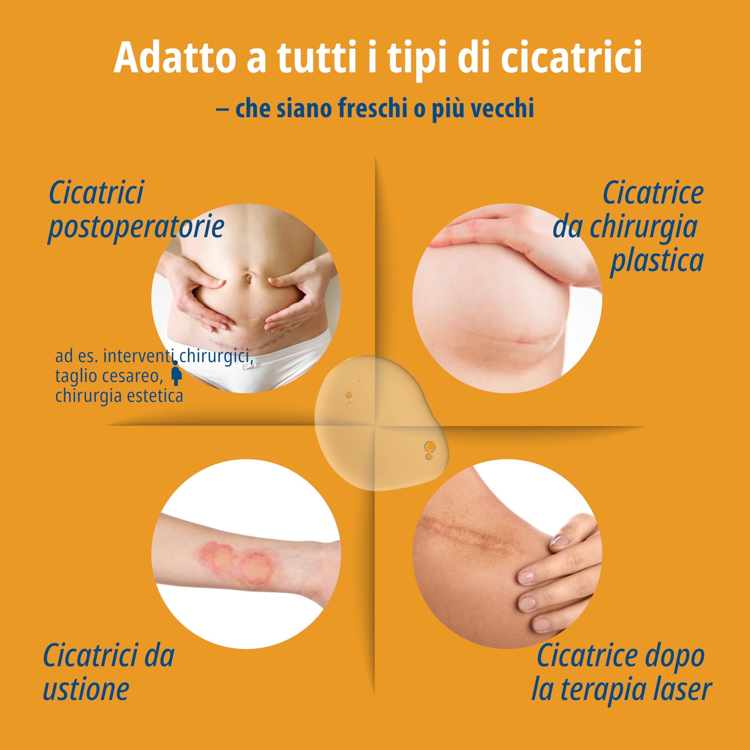 Evolsin Gel silicone per cicatrici 20 g riduce visibilità tensione prurito