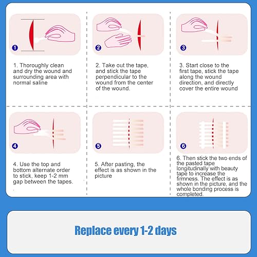 Miniatura 2 de Tira de cierre de piel, cinta adhesiva de cierre de herida, reposabrazos, para niños y adultos, cortable, higiénico, puntada de cremallera, vendaje