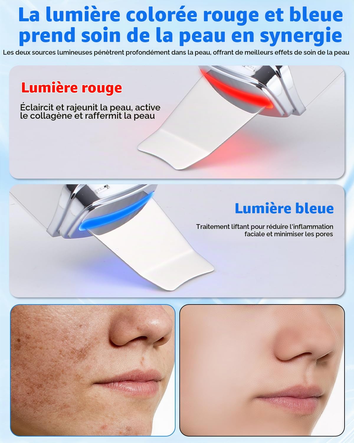 Aspirateur Point Noir, Avec 4 Modes Cisage et Intensité Réglable, Aspirateur Point Visage, Lumière Rouge et Bleue, Affichage LED et Fonction d'arrêt Automatique, Epurateur de peau Visage