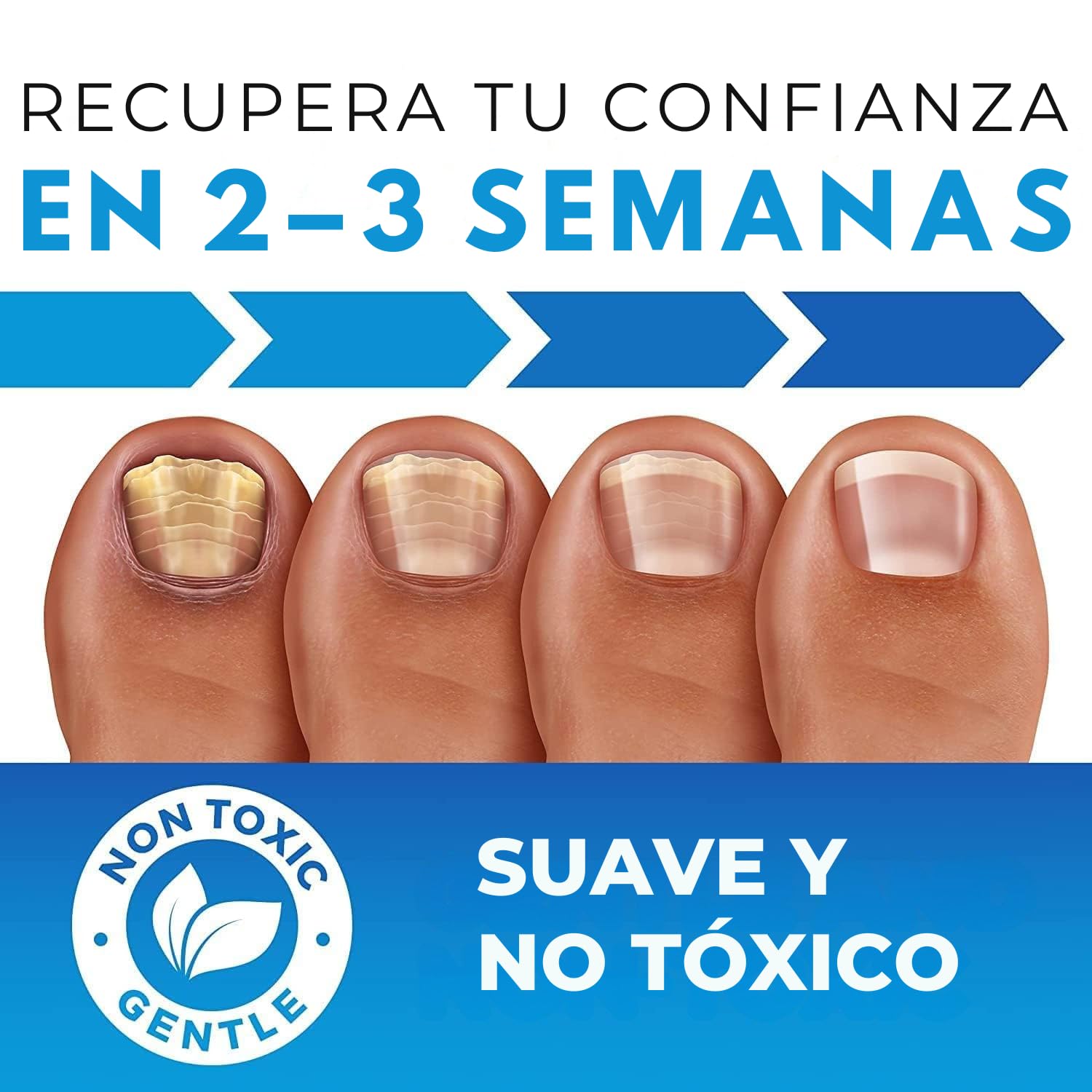 Imperial Feet Nail Mycosis Quita Hongos Uñas Pies-Tratamiento Hongos Uñas Pies-Fortalecedor de Uñas-Ablandador de Callos y Durezas-Tratamiento Hongos Uñas-Reparador Uñas Dañadas y Debiles-XL 75ML