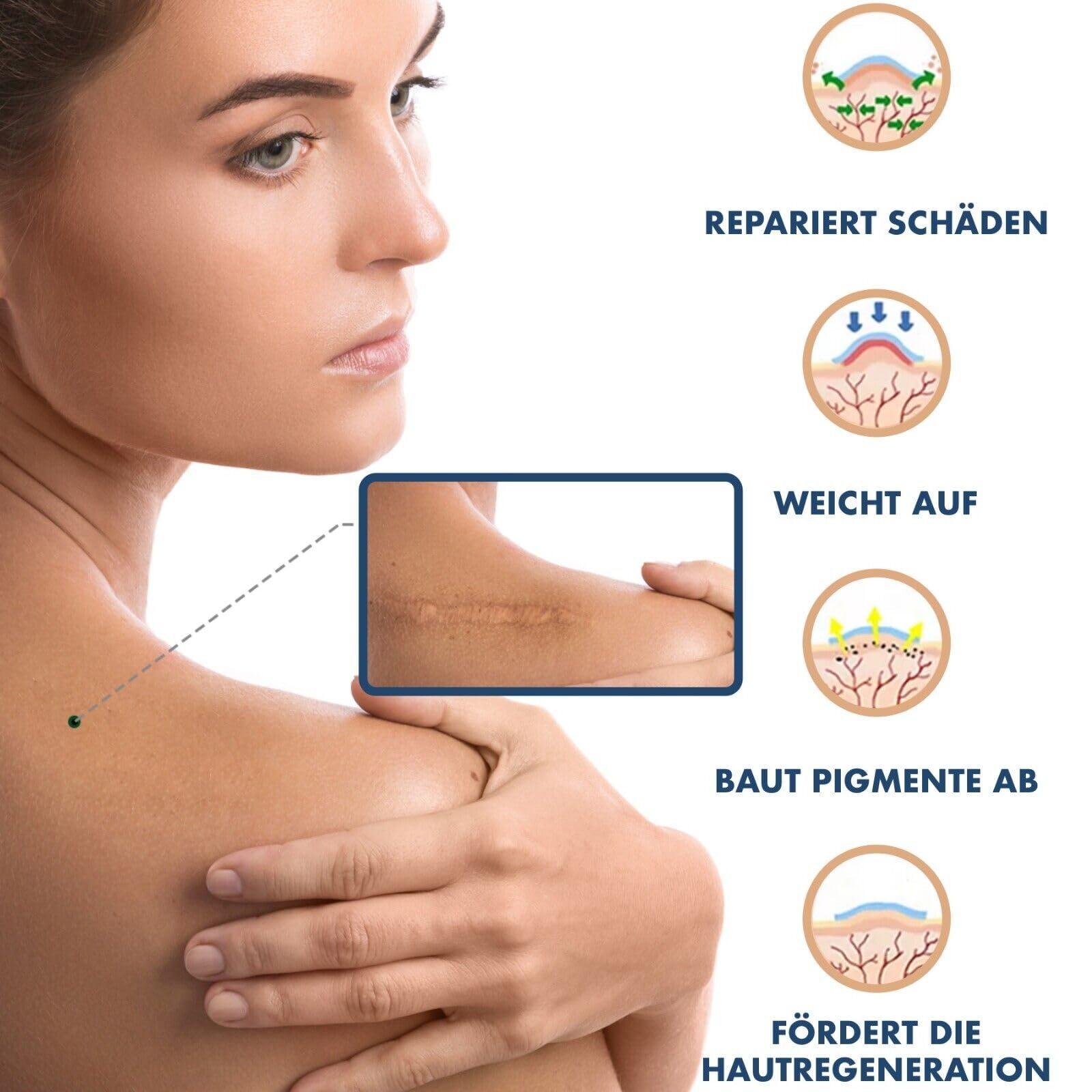 P-Beauty Silikonpflaster zur Narbenreduktion 4cm x 3,2m | Selbstklebendes, medizinisches Narbenpflaster | wiederverwendbar | gegen Akne, Keloid, OP & Verbrennungsnarben | Silikon Narbenrolle