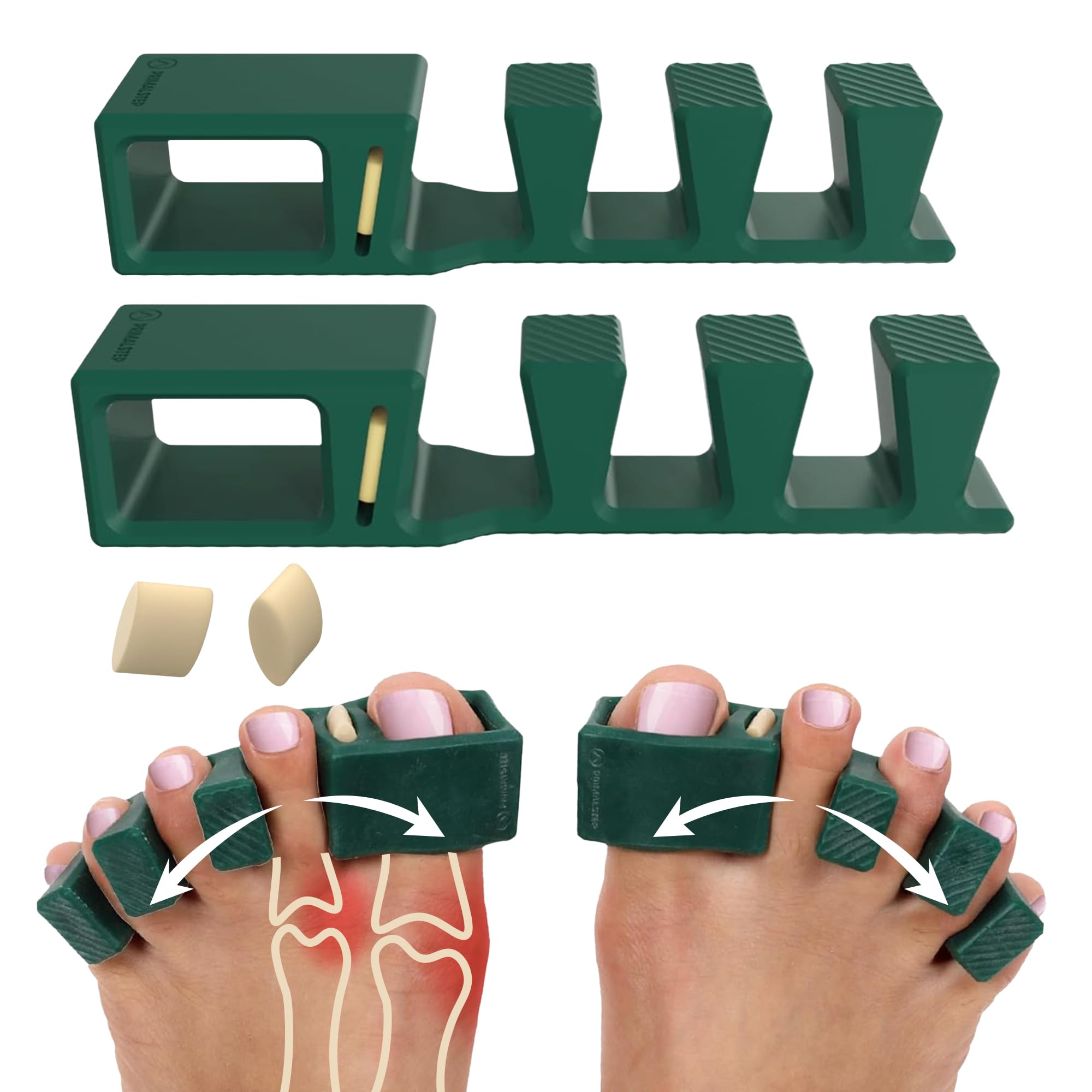 APEX Adjustable Toe Separators