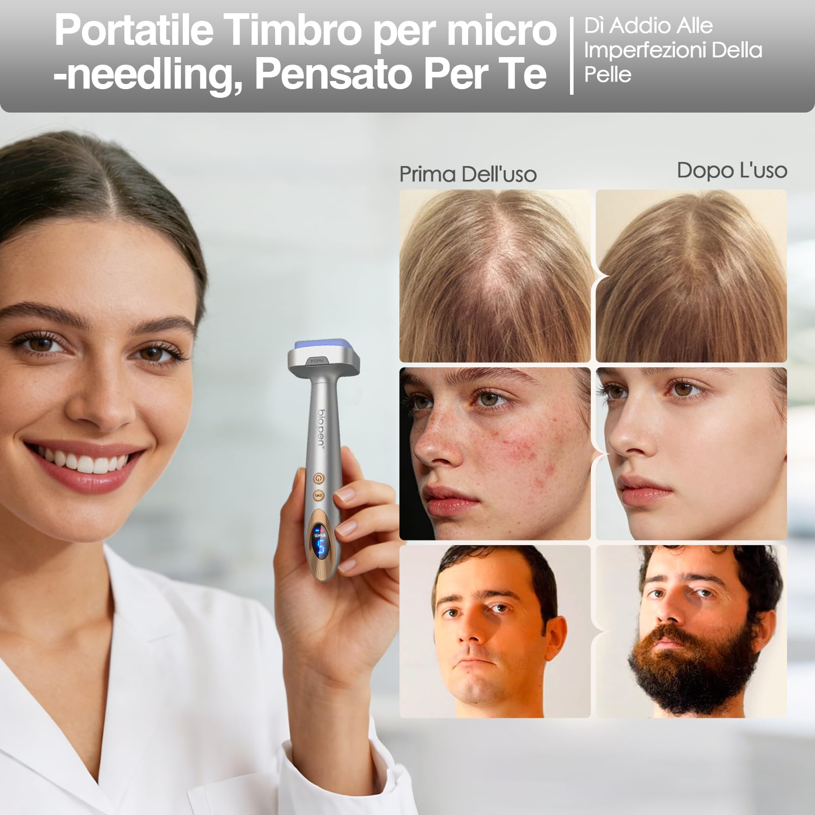 Bio 6 Dermastamp Elettrico Professional 0.5 mm Derma Stamp, 140 Aghi in Acciaio Inox di Alta Qualità, Vibrazione ad Alta Frequenza, Cura con Luce Rossa e Blu, per Capelli, Barba, Viso, Corpo