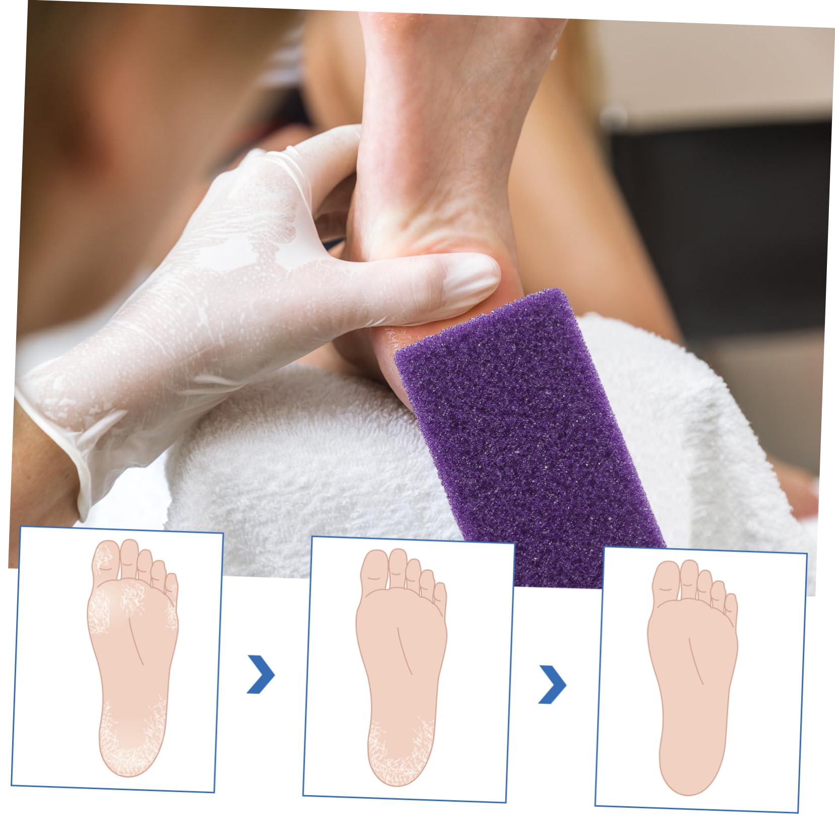 Pietra Pomice per Piedi Rimozione Calli Porpora 6 Pezzi | Pu, Portatile e Leggero, Trattamento Levigante, Formato da 6 Pezzi per Cura Piedi