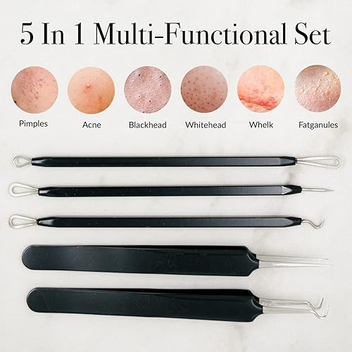 Miniatura 2 de Pete & Pedro Juego de herramientas para el cuidado de la piel para eliminar acné y puntos negros para hombres y mujeres, kit de 5 piezas para