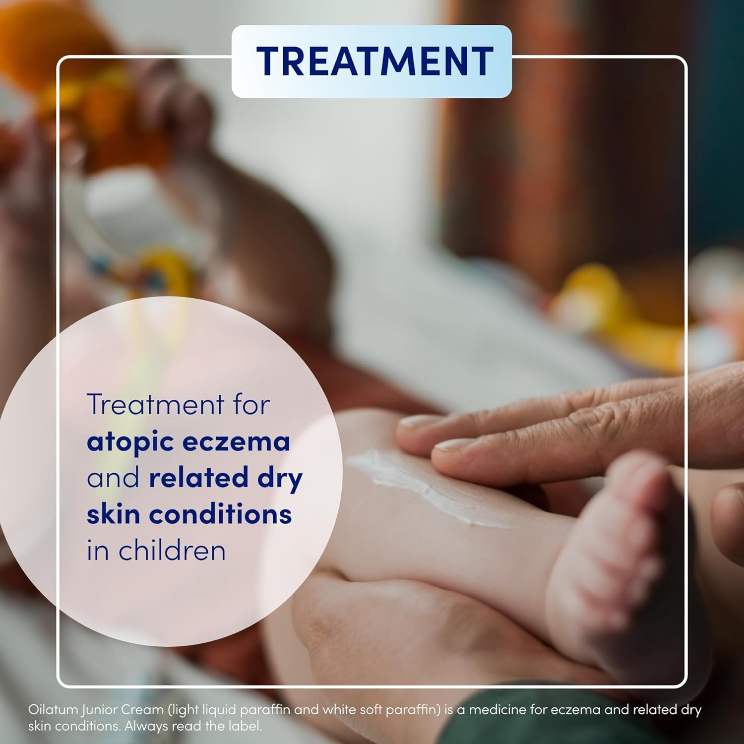 Oilatum Junior Cream 500g - Image 4