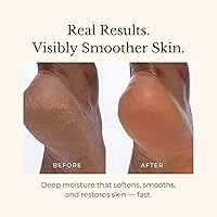 Vista 6 de Juara - Crema corporal Candlenut Loción hidratante Hidratación de piel seca Crema para la piel, manos y pies Bálsamo calmante