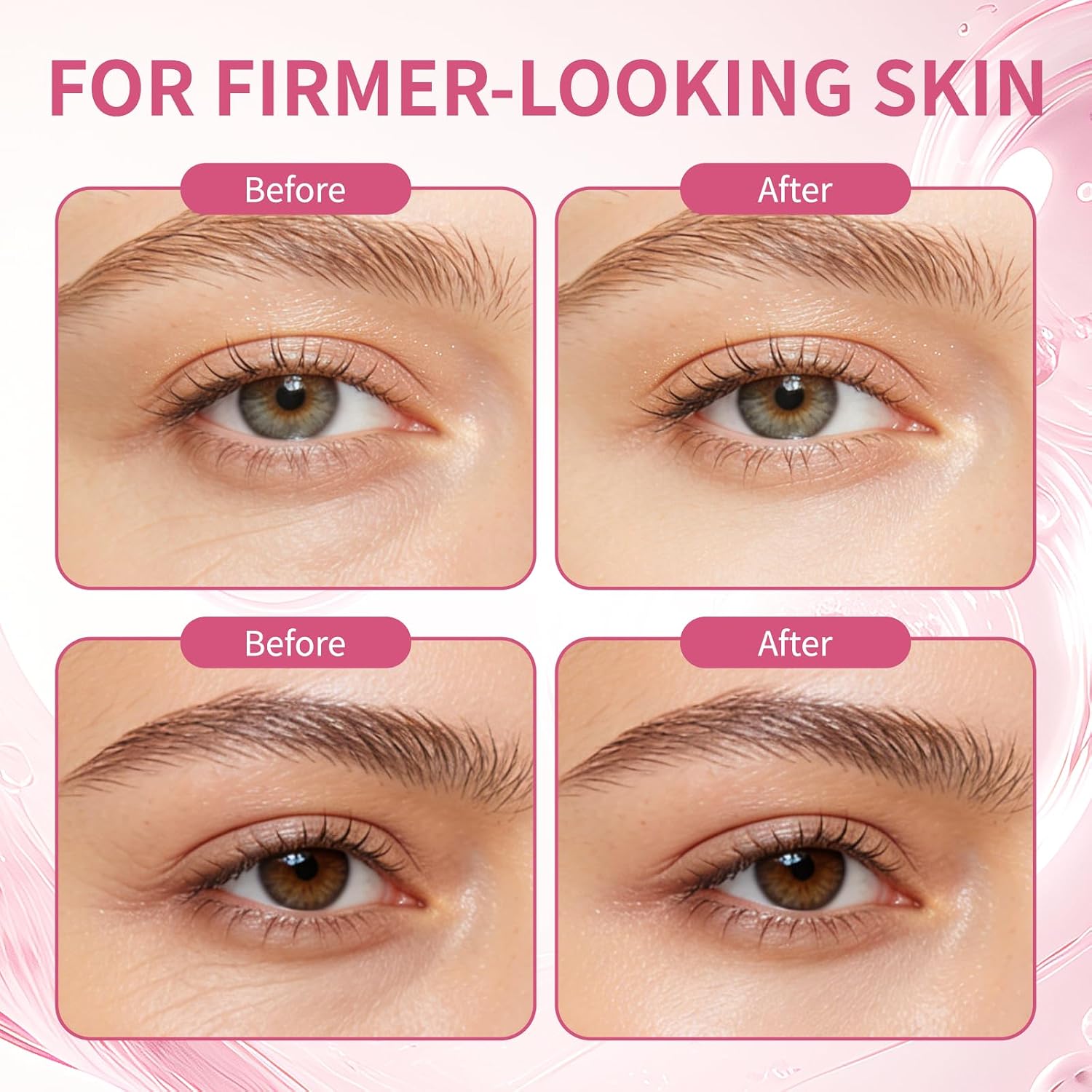 PDRN Pink Peptide Eye Serum Cream, Hydrating & Firming Eye Cream for Dark Circles, Anti-Aging Treatment Reduces Fine Lines, Uneven Skin Tone, Soothing Pink Moisturizer with Peptides, 1.01fl.oz (1)