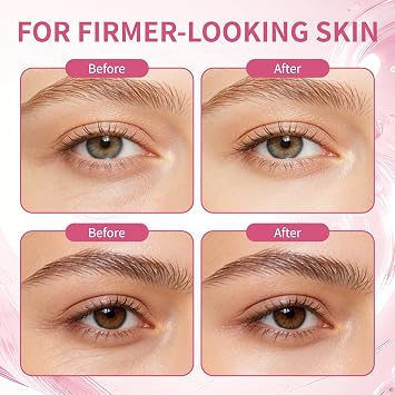 PDRN Pink Peptide Eye Serum Cream, Hydrating & Firming Eye Cream for Dark Circles, Anti-Aging Treatment Reduces Fine Lines, Uneven Skin Tone, Soothing Pink Moisturizer with Peptides, 1.01fl.oz (2)